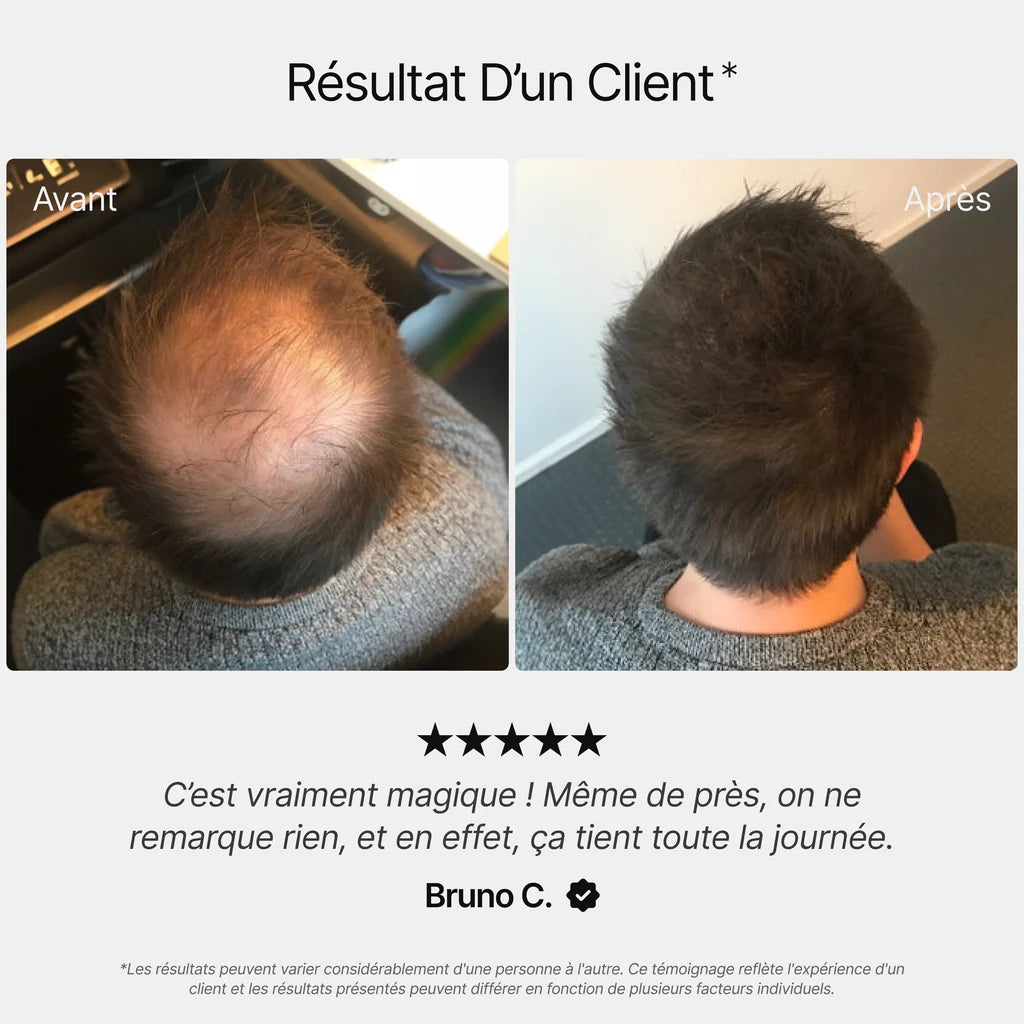 Lushl™Des Cheveux Denses en 5 Secondes – Facile à Appliquer réutilisable à domicile